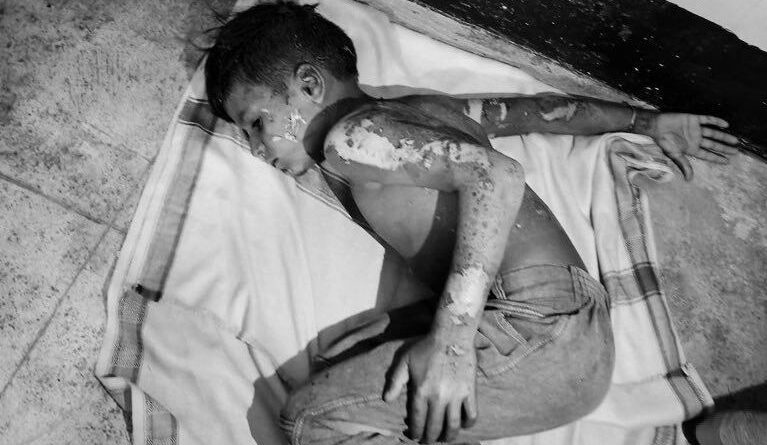 deadly-kite-string-shock-sangareddy