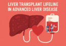 liver-transplant-advanced-liver-disease