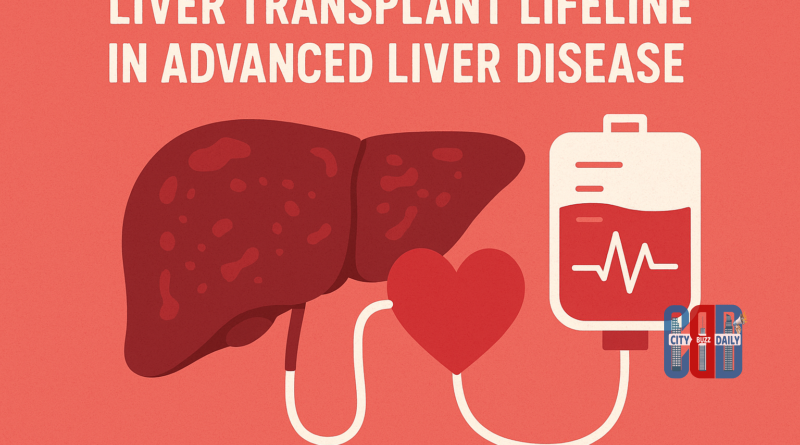 liver-transplant-advanced-liver-disease