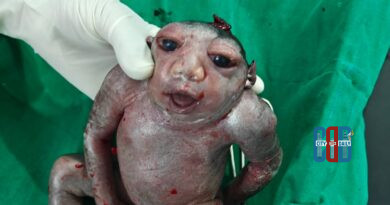 Doctors performing emergency surgery at Chinturu Community Health Centre