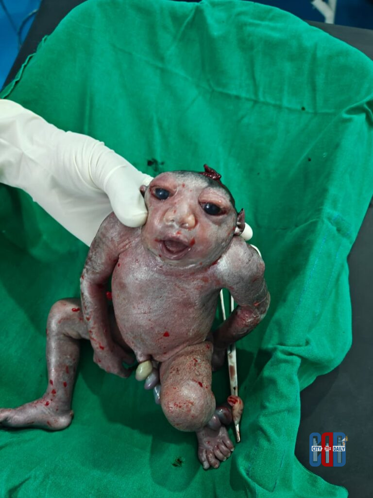 Doctors performing emergency surgery at Chinturu Community Health Centre