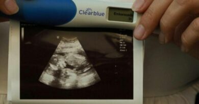 Five women develop kidney failure post‑delivery at Rajasthan’s Bikaner hospital