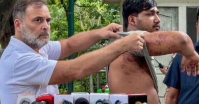 Rahul shows pellet gun injuries of protester to slam govt, says ‘stop assaulting our students’