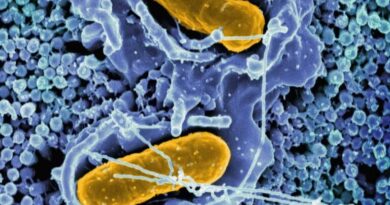 Hyderabad doctors warn Widal test may cause typhoid misdiagnosis amid viral fever surge